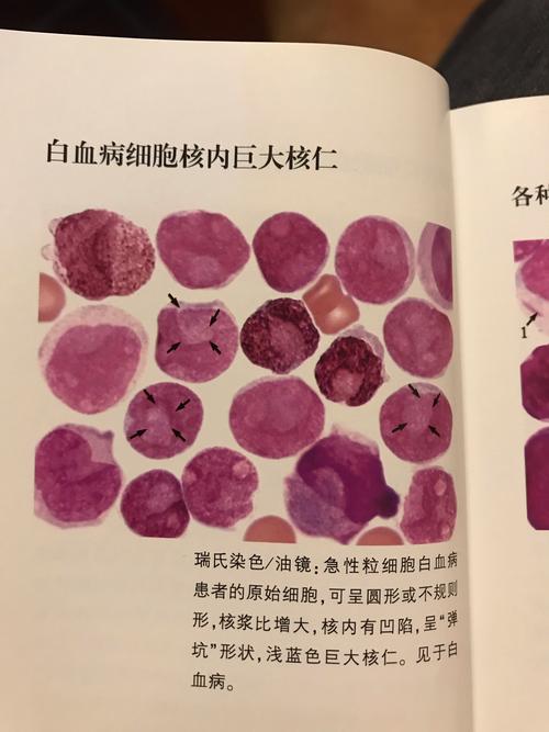 粒细胞的各种形态