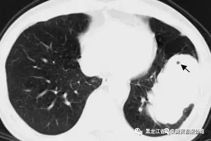 x线 x光 x光片 x线 431_288