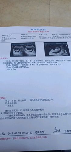 宝宝十二周nt 彩超