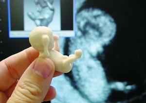 与b超对比,12周大小胎儿的模型显得更逼真.