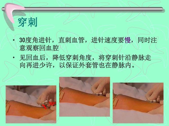 慢,同时注 意观察回血腔   见回血后,降低穿刺角度,将穿刺针沿静脉走