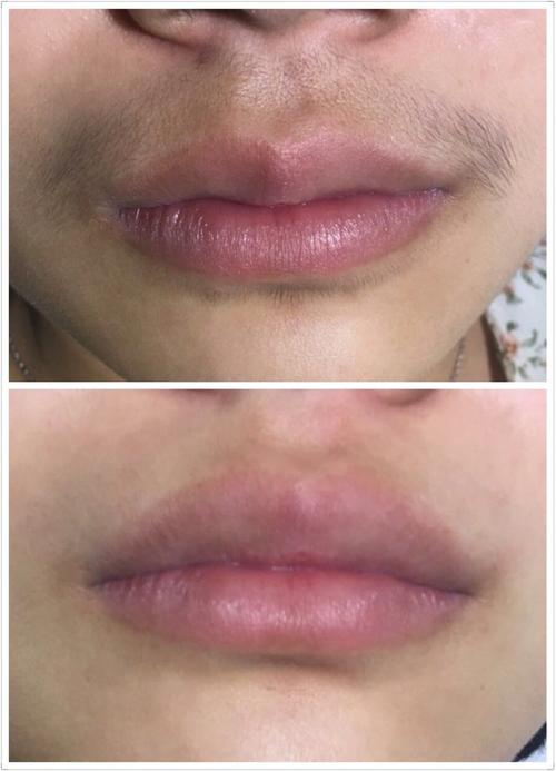 对比了很多家,最后还是选择了这里,店里面的设施看起_圈子-新氧美容