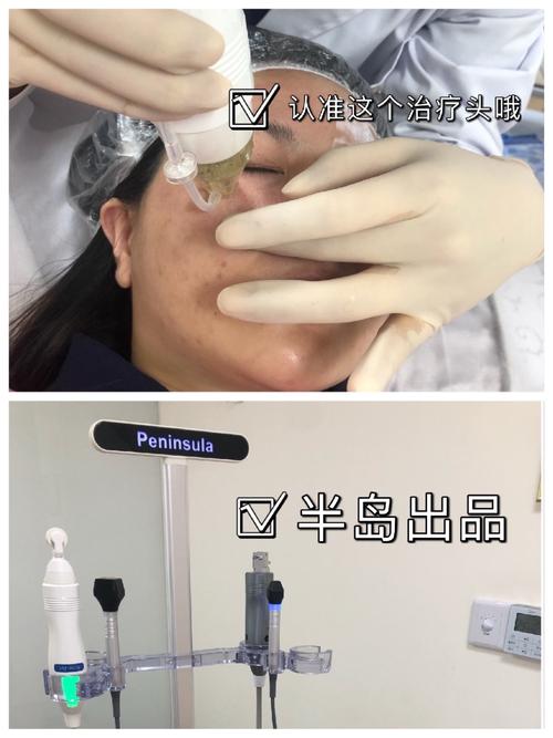 体验项目:半岛黄金微针眼周