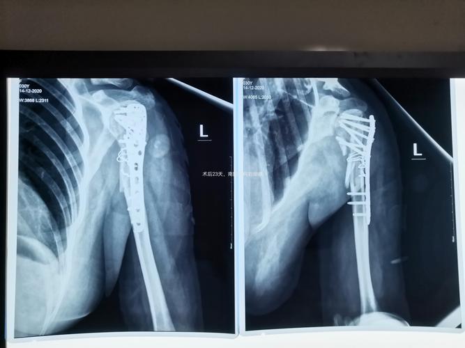 患者王yun,女,30岁,镇平