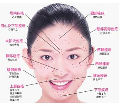 不同部位长痘该如何应对?