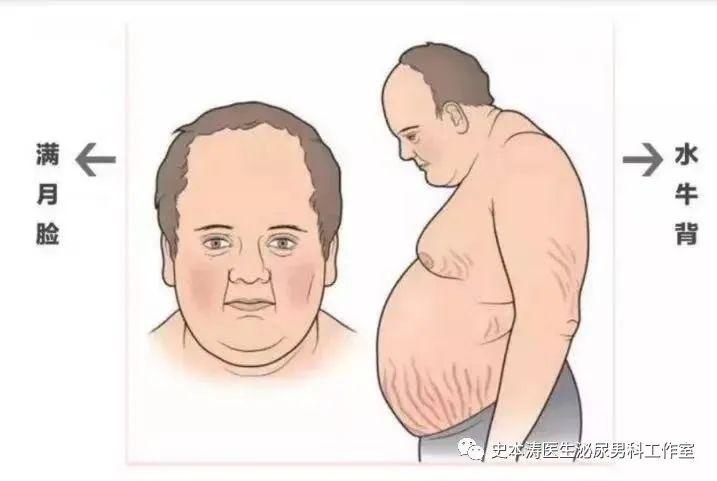 无故变胖留意您的肾上腺