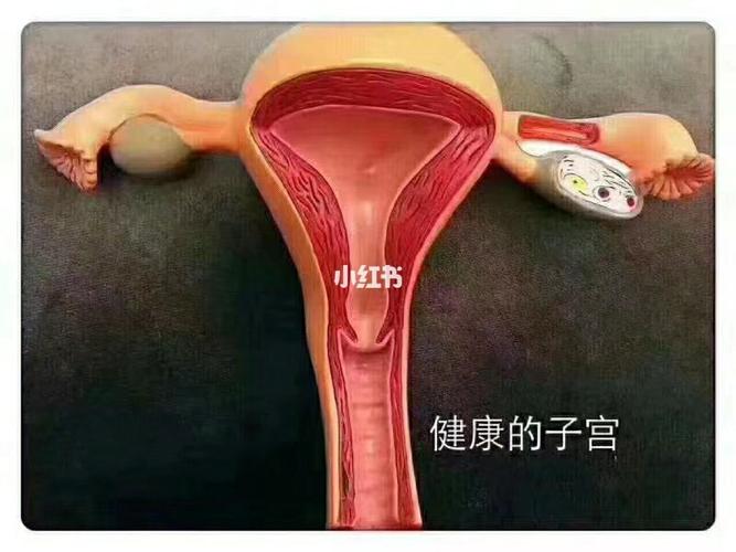 68始病变43阴66道66炎60_子宫_妇科_医疗健康_医疗健康其他