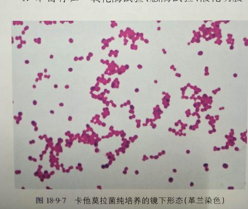 革兰阴性球菌:淋病奈瑟菌,脑膜炎奈瑟菌 1.