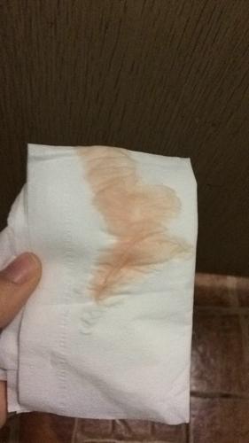 医生说我有宫颈糜烂轻度,给我开了塞的药,保妇康栓.