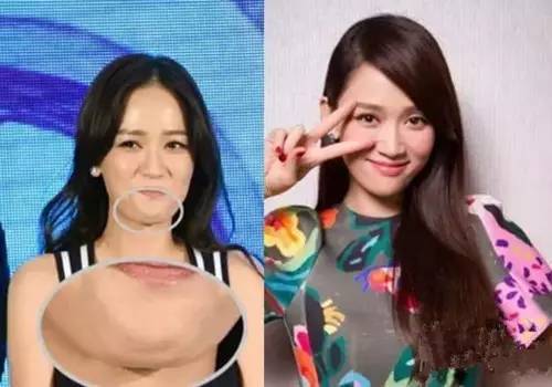 被双下巴毁了的女神照:赵薇林心如秒变大妈(图)(7)