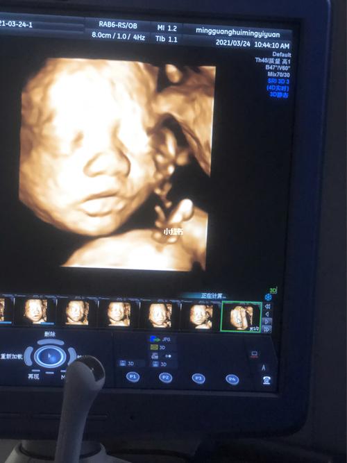 四维b超_四维彩超_胎儿_母婴_孕产经验