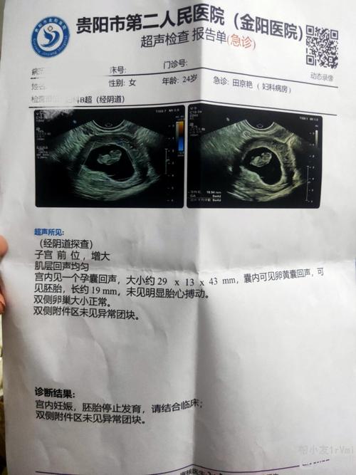 怀孕9周了,我和老公本来都很高兴期待宝宝