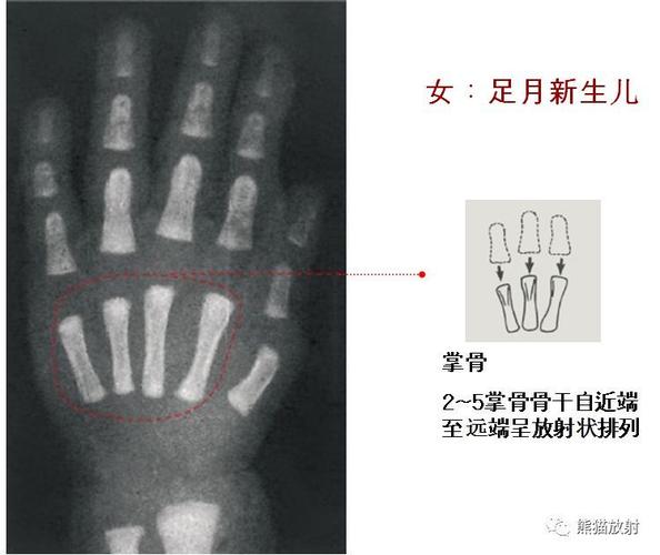 儿童生长发育骨龄图谱