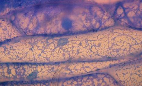 光镜下观察到细胞骨架有何形态特征