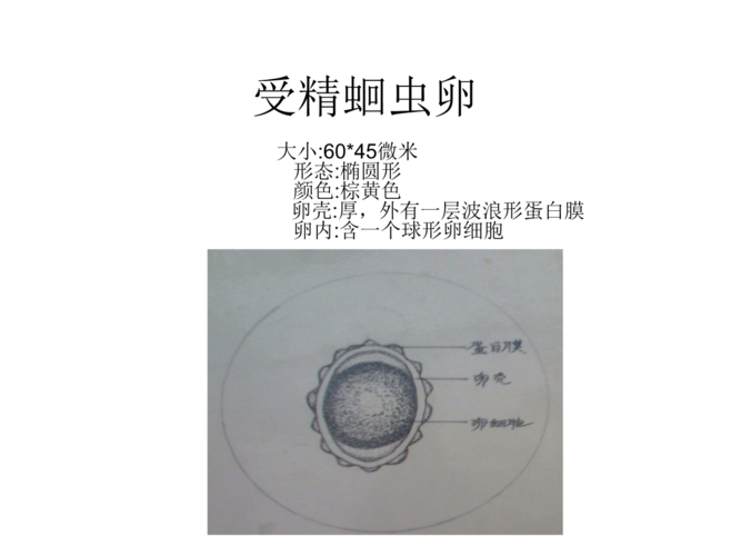 医疗医学受精蛔虫卵.ppt