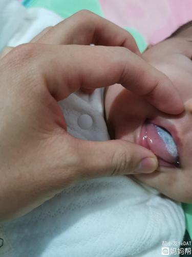 有没有人知道为什么宝宝舌苔这个颜色了?纯