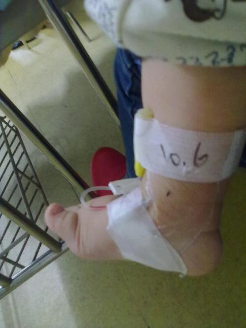 放点宝宝打针的照片,记住我们的第一次住院,引以为戒