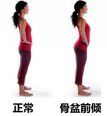"骨盆前倾",毁了多少健身女孩?