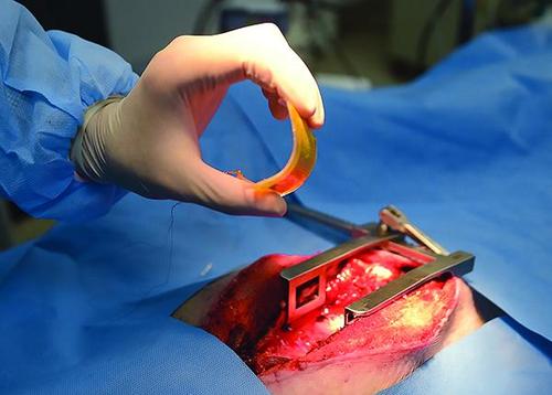 不用电池的心脏起搏器