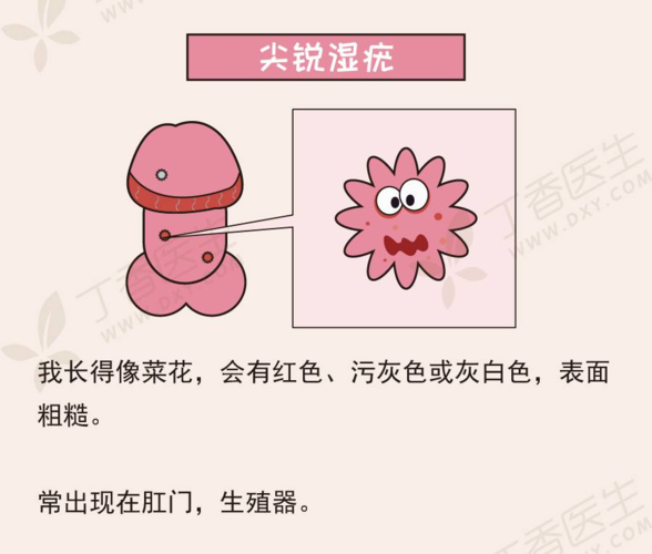 怎么判断珍珠疹和尖锐湿疣呢,前3个月有