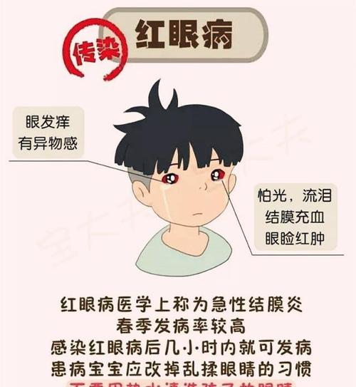 谨记:"红眼病"属丙类传染病
