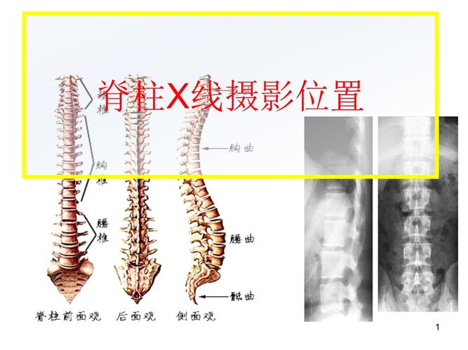 脊柱x线摄影技术幻灯片.ppt 70页