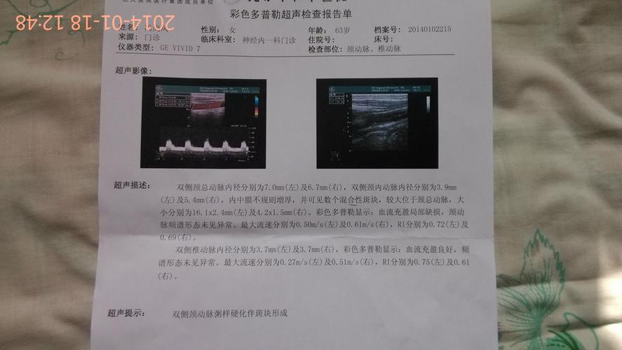 家母彩超检查"双侧颈动脉粥样硬化伴斑块形成",请教如何治疗,谢谢!