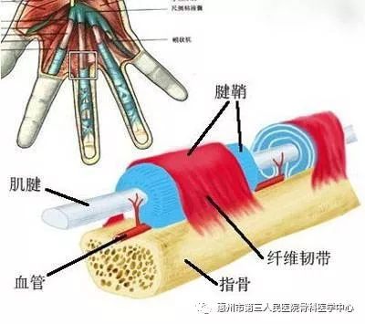 狭窄性腱鞘炎有哪些临床表现?
