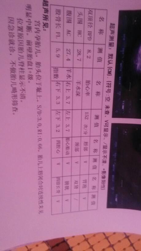 问:怀孕七个月,羊水指数3.7 是什么意思