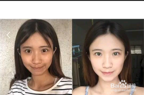 晒黑了怎么变白