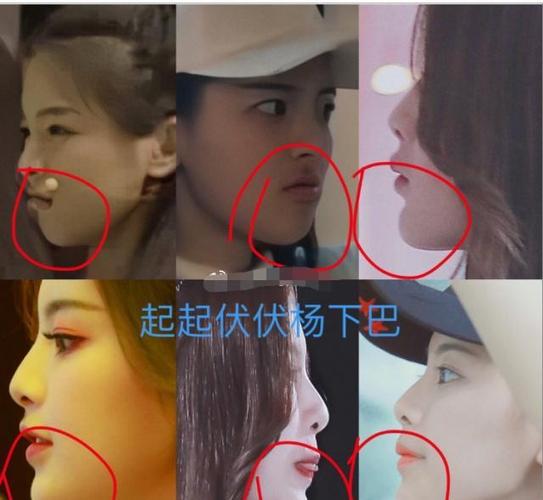 杨超越又陷整容风波网友扒出医生还其垫过下巴不是天然美女