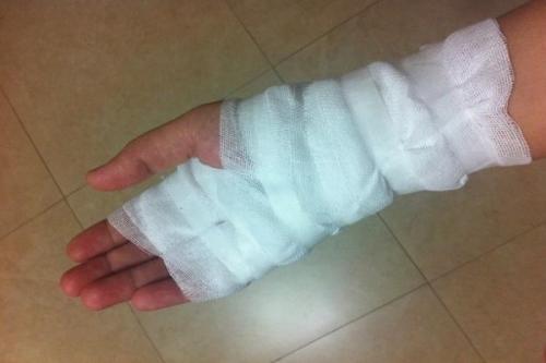 夏天有比较严重的一个烫伤,有哪些中成药可以很好的缓解这种病情?