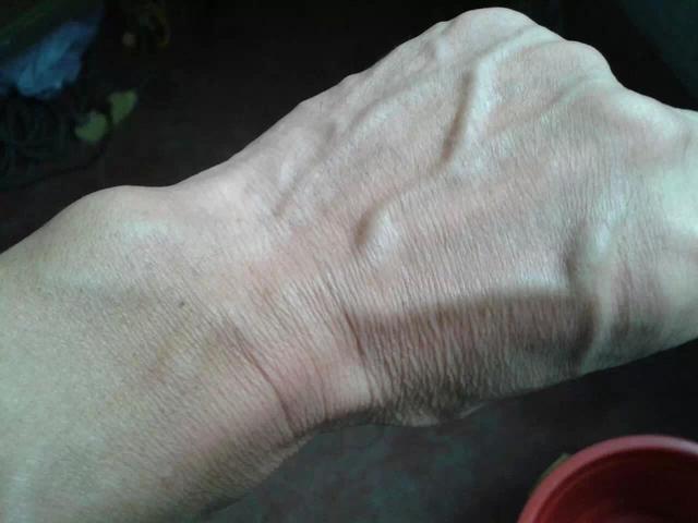 为什么有人手背上的青筋很粗很明显?别乱猜,这次告诉你真正答案