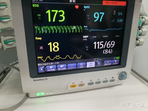 这是用药过程中的一张图. 心律平静推,要求边推边看心电监护.