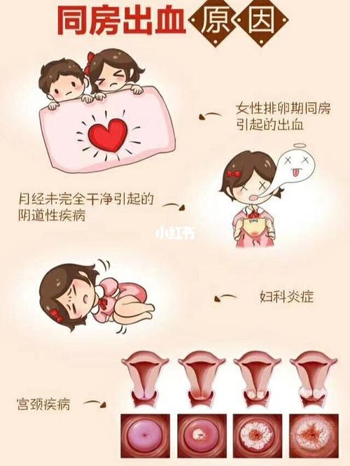 同房出血主要原因有女性排卵期同房引起的出血,月经未