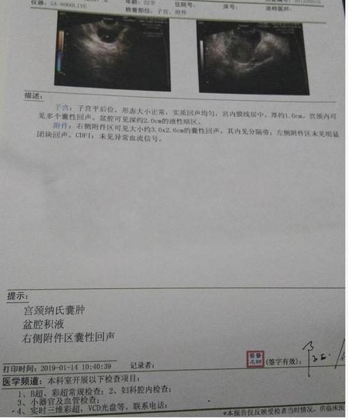 嗯, 那是囊肿——宫颈纳氏囊肿对女性有什么危害?