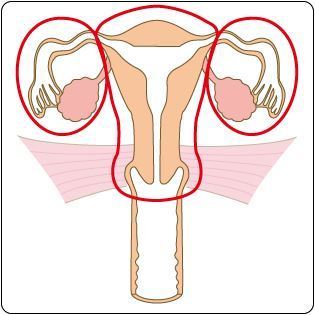次广泛全子宫切除术和双侧附件切除术的范围 切除输卵管,卵巢,阴道和
