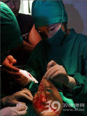 惊人的变脸手术实拍(组图)