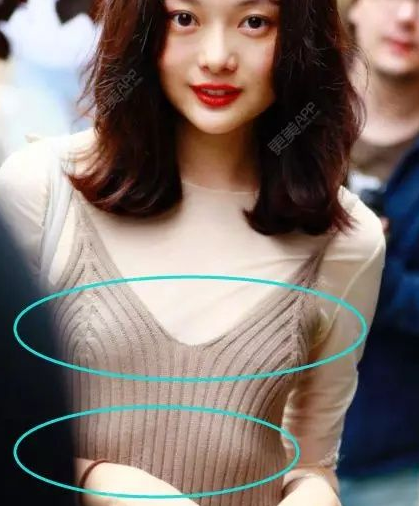 多数女性虽然瘦却一眼可见肋骨外翻的体态教你怎么改正