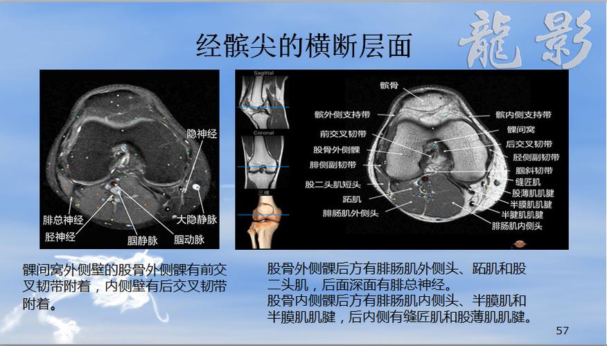 膝关节断层解剖