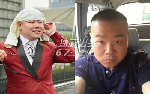 小岳岳爱美颜后五官都快磨没了