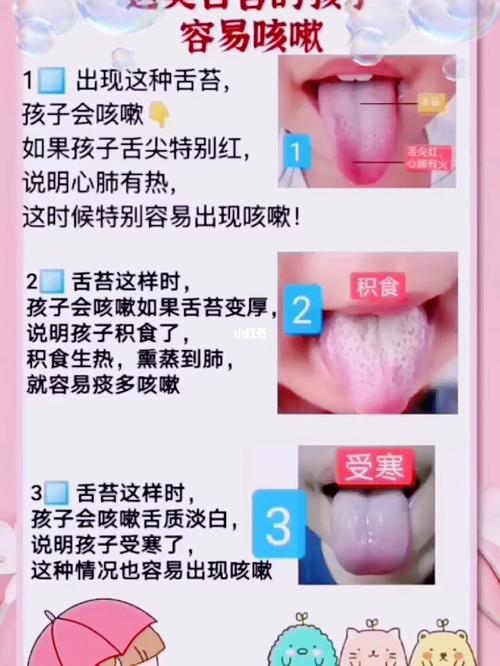 宝妈们,可以观察一下宝宝的舌苔哦… 我家宝宝积食的时候,我真的就