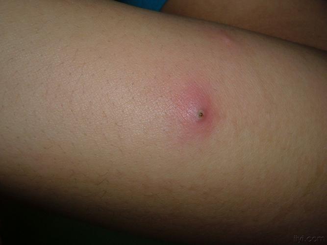 看看这个是什么病有图片