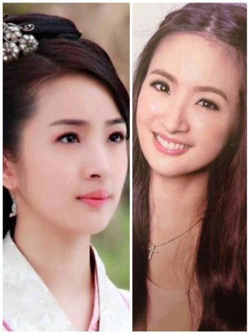 看看戚薇,林依晨,原先短小后缩的下巴,显得脸钝钝的带点憨,下巴调整后