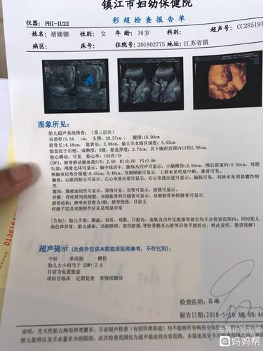 四维过了,可是胎盘低置,要不要紧啊