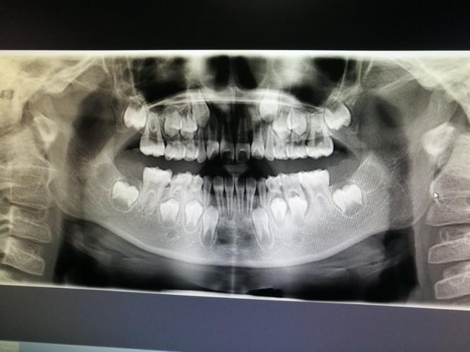 口腔ct让你的牙齿更加健康美丽
