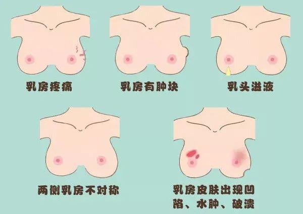 1分钟学会「乳房自检」,拒绝乳腺癌!