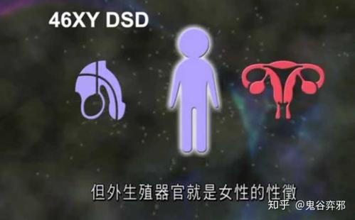 分不出染色体是男性还是女性但同时拥有睾丸,卵巢两种性腺.