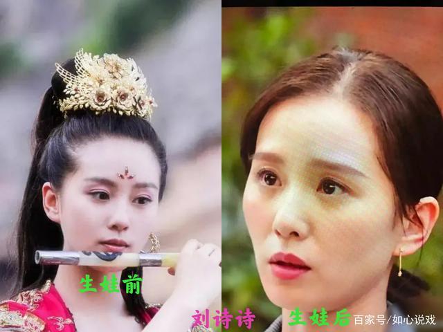 刘诗诗在《亲爱的自己》里面眼窝凹陷,法令纹深,面部塌陷.