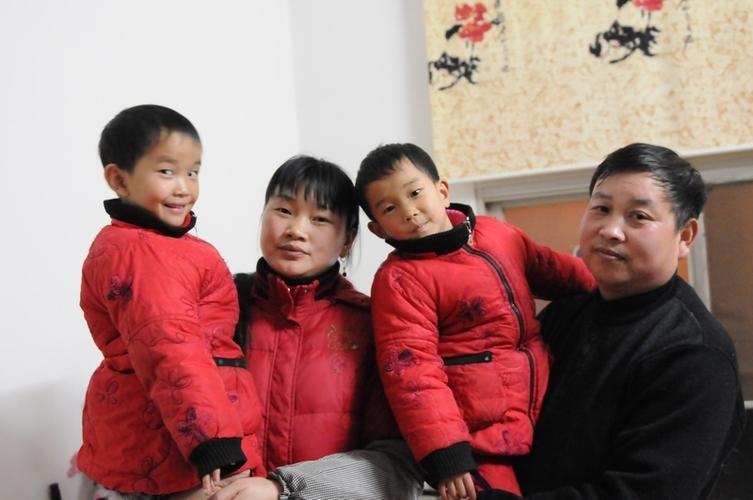 今日,在武汉协和医院,中国首例成功分离的"坐骨连体"女婴张玲,张珑,与